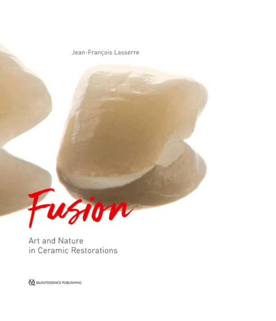 Ceramic Restorations: The Fusion of Art and Nature in Modern Dentistry