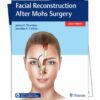 Complete SEO Article: Facial Reconstruction After Mohs Surgery