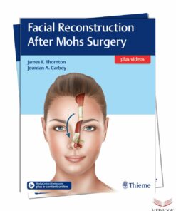 Complete SEO Article: Facial Reconstruction After Mohs Surgery