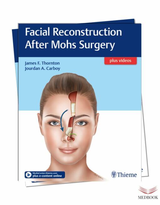 Complete SEO Article: Facial Reconstruction After Mohs Surgery