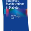 Cutaneous Manifestations of Diabetes: Understanding and Managing Skin Conditions in Diabetes 2024