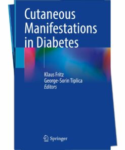 Cutaneous Manifestations of Diabetes: Understanding and Managing Skin Conditions in Diabetes 2024