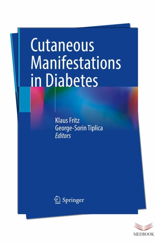 Cutaneous Manifestations of Diabetes: Understanding and Managing Skin Conditions in Diabetes 2024