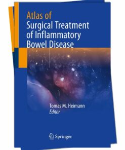 Comprehensive Guide to Surgical Treatment of Inflammatory Bowel Disease 2024