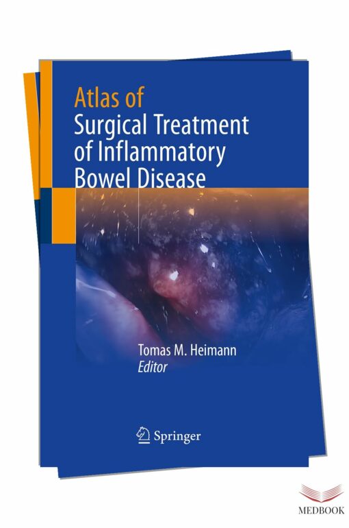 Comprehensive Guide to Surgical Treatment of Inflammatory Bowel Disease 2024