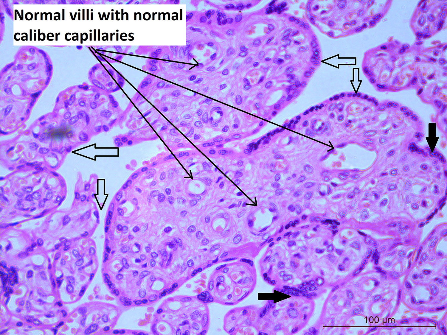 Placental Pathology 2025: A Comprehensive Guide to Understanding Placental Disorders and Abnormalities