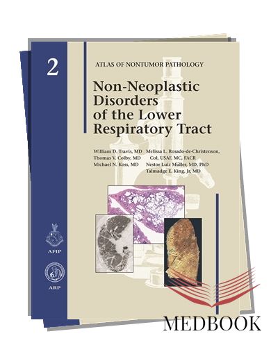 Non-Neoplastic Disorders of the Lower Respiratory Tract: A Comprehensive Guide to Lung Pathology