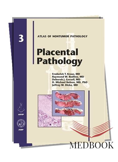 Placental Pathology: A Comprehensive Guide to Understanding Placental Disorders and Abnormalities