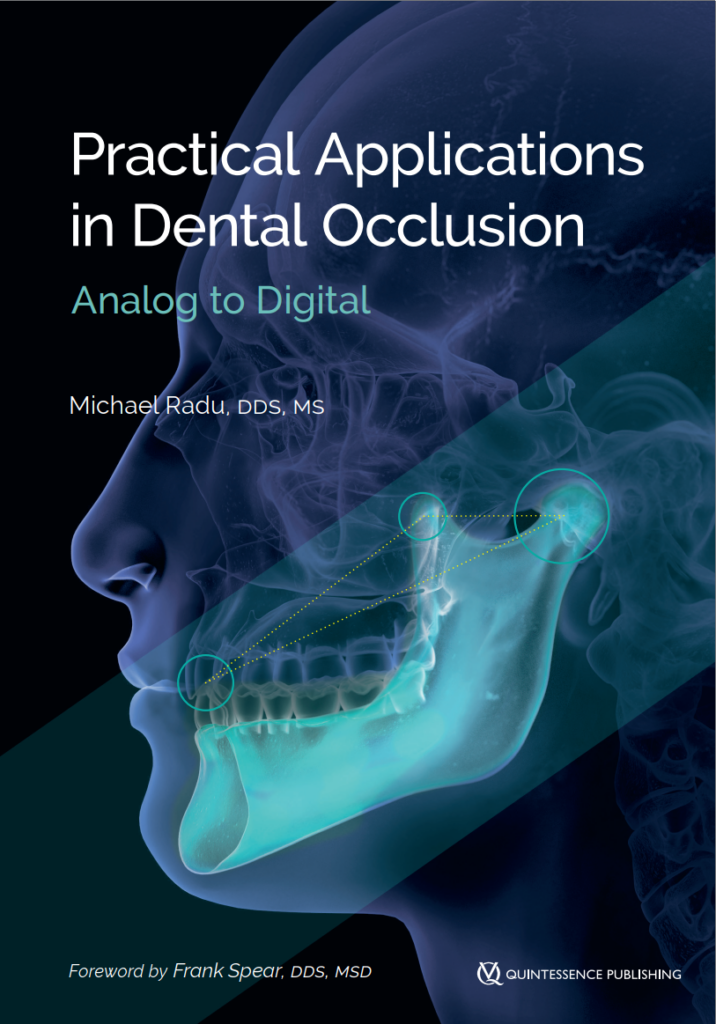 Dental occlusion